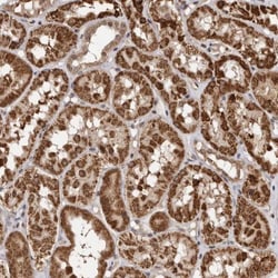 CCDC190 Antibody, Novus Biologicals 0.1mL; Unlabeled:Antibodies, Polyclonal